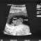 baby-ultrasound1crop.jpg