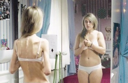 Tjeskoba može biti podloga za anoreksiju