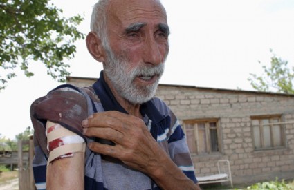 Stanovnik Južne Osetije pokazuje ranu koju je zadobio u pucnjavi u selu udaljenom samo 100 km od Tbilisija