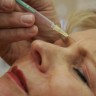 U EU 600 sumnjivih slučajeva tretmana botoxom 