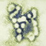Prvi slučaj gripe A (H1N1) u BiH