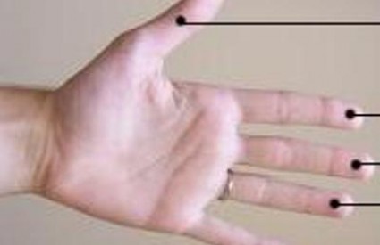 Duljina prstiju utječe na osteoartrozu