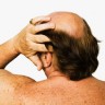 Tri loše navike zbog kojih muškarci gube kosu