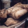 Od tuberkuloze se umiralo još u doba faraona