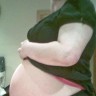 Mislili da je trudna, no dijagnoza pokazala cistu od 7 kg