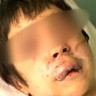 Maloljetnici vršnjaka tukli satima i glavom mu udarali u stup