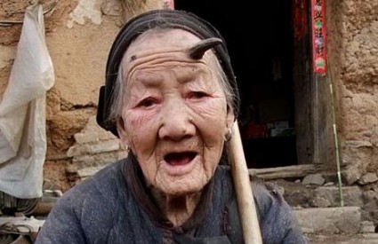 Kineskinji izrastao misteriozni rog nasred čela