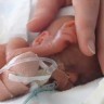 Liječnici spasili najmanju bebu na svijetu
