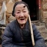 Kineskinji izrastao misteriozni rog nasred čela