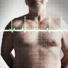 Tihi infarkt je opasniji za muškarce