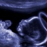 Plakati s bebom Isusom u maternici raspiruju debatu o pobačaju