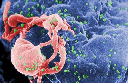 Virus HIV-a