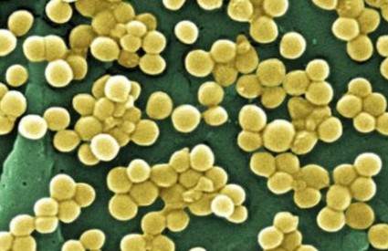 Rezistentne bakterije postaju prošlost?
