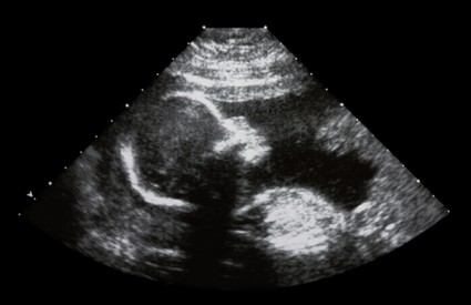 Bebe prepoznaju govor i tri mjeseca prije rođenja