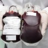 Transfuzija mlade krvi sprječava starenje?