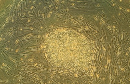 embrionalne matične stanice