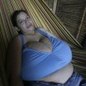 Žena muku muči s grudima teškim 10 kg