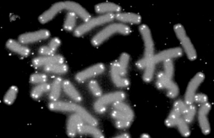 Ljudski kromosomi (sivo) s telomerama (bijelo)