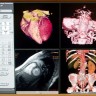 Liste čekanja u Hrvatskoj - MR 114, CT 43, a ultrazvuk dojke 319 dana