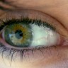 Dijagnoza zdravstvenog stanja iz očiju - I. dio