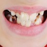 Zašto nas je evolucija kaznila lošim zubima?