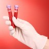 Krvne grupe i darivanje krvi