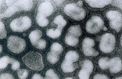 Virus gripe tipa A
