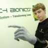 Mercedes poklonio mladiću bioničku ruku