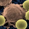 T-stanice ubijaju stanice raka kod oboljelih od leukemije