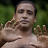 Kubanac s 24 prsta postao prava turistička atrakcija