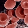 Znanstvenici s Harvarda stvorili čestice koje uništavaju krvne ugruške