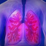 Genska terapija izliječila infekciju pluća