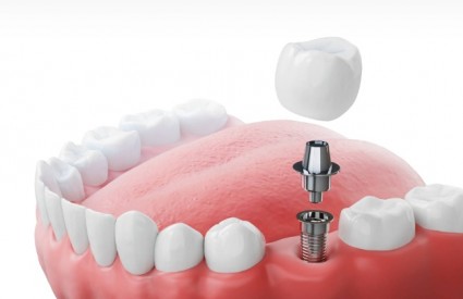 Jednostavno i kvalitetno rješenje Jednostavno i kvalitetno rješenje